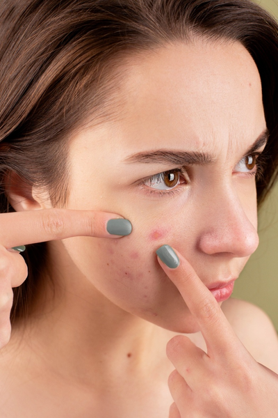 Using Carrot Seed Oil For These 5 Skin Concerns